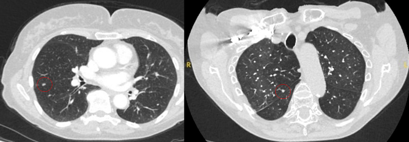 com.bmj.content.model.assessment.Caption@73a5df7e