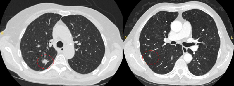 com.bmj.content.model.assessment.Caption@6e27f8dc