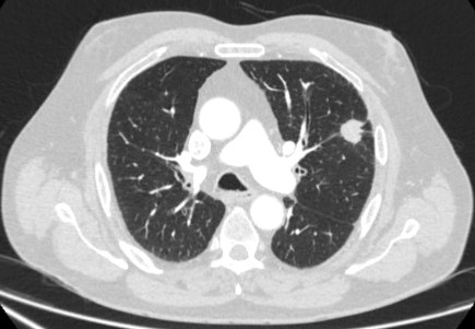 com.bmj.content.model.assessment.Caption@4446e282