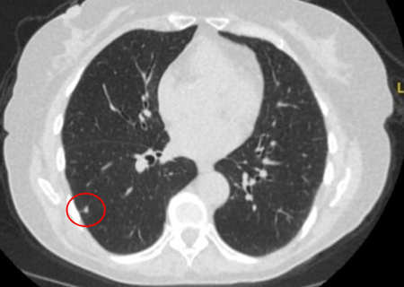 com.bmj.content.model.assessment.Caption@483bd186