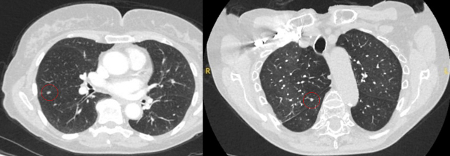 com.bmj.content.model.assessment.Caption@663d4494