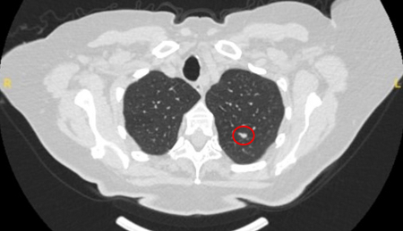 com.bmj.content.model.assessment.Caption@199a0551