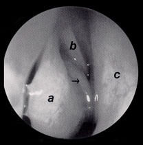 com.bmj.content.model.assessment.Caption@78e73286