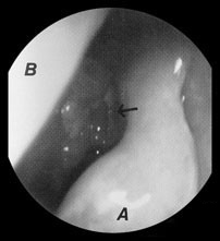 com.bmj.content.model.assessment.Caption@631c5c32