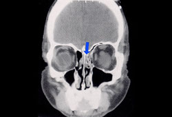 com.bmj.content.model.assessment.Caption@654dd6e8