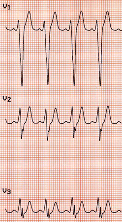 com.bmj.content.model.assessment.Caption@63419ac2