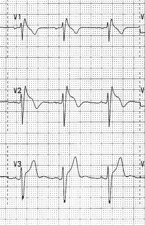 com.bmj.content.model.assessment.Caption@30446086