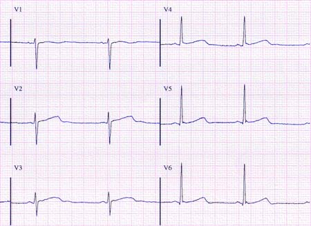 com.bmj.content.model.assessment.Caption@604eb177