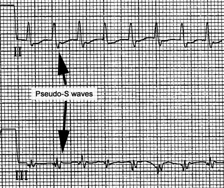 com.bmj.content.model.assessment.Caption@44c80541
