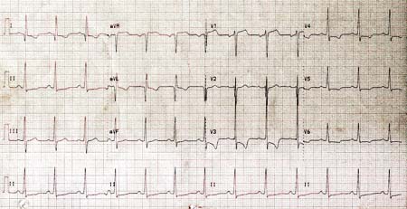 com.bmj.content.model.assessment.Caption@70a56a84