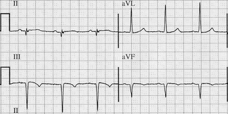 com.bmj.content.model.assessment.Caption@3280fbca