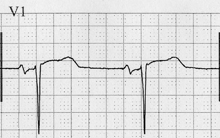 com.bmj.content.model.assessment.Caption@59070e80