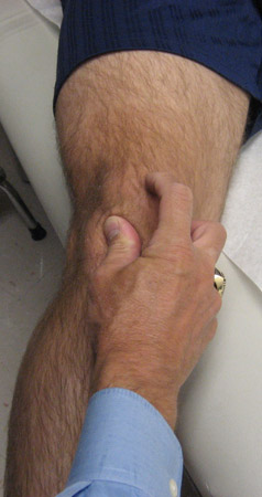 com.bmj.content.model.assessment.Caption@4be3a249