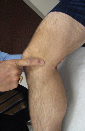 com.bmj.content.model.assessment.Caption@6175f07e