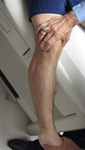 35