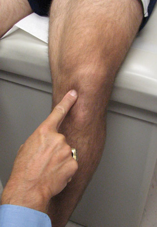 com.bmj.content.model.assessment.Caption@62a50730