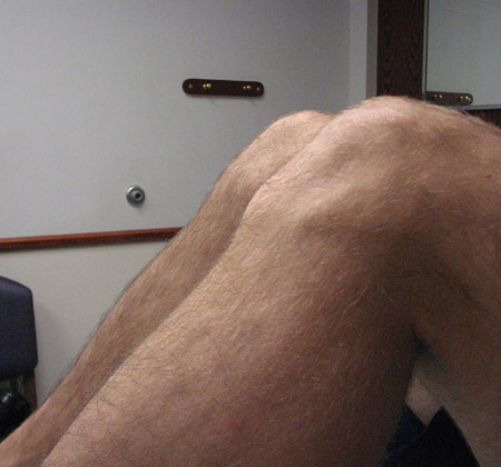 com.bmj.content.model.assessment.Caption@1f45a4