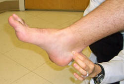 Tendinopathy images