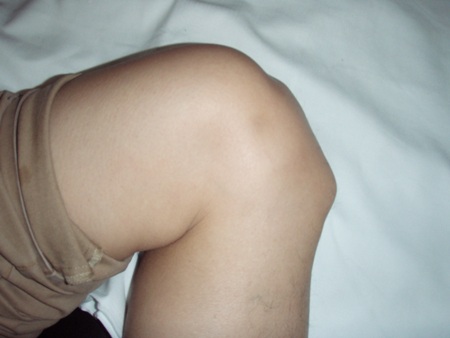 com.bmj.content.model.Caption@6b75f550