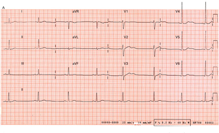 com.bmj.content.model.assessment.Caption@261aa5c8