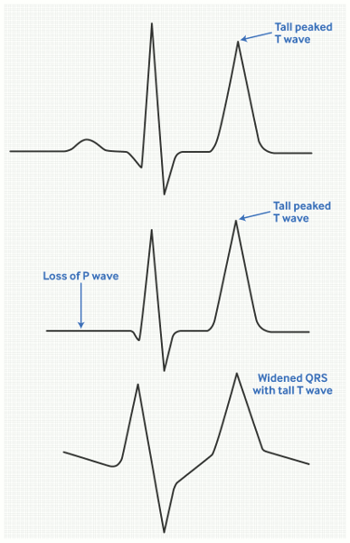 com.bmj.content.model.assessment.Caption@fcbed29