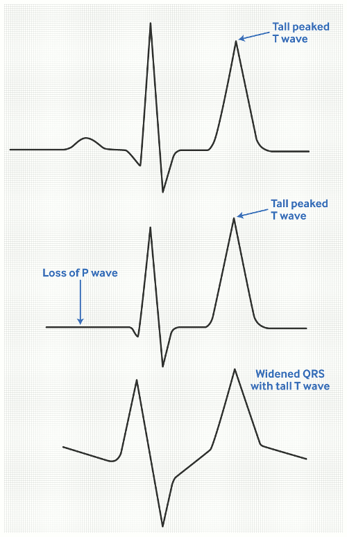 com.bmj.content.model.assessment.Caption@2cc9a12d