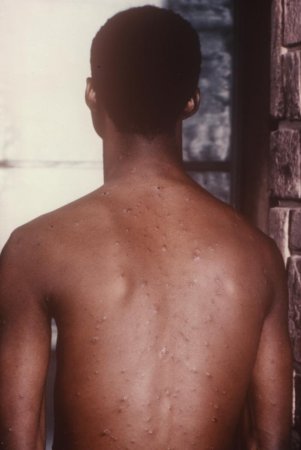 com.bmj.content.model.Caption@58d39aa8