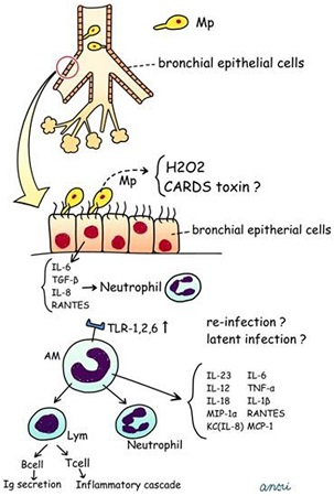 Mycoplasma pneumoniae infection images