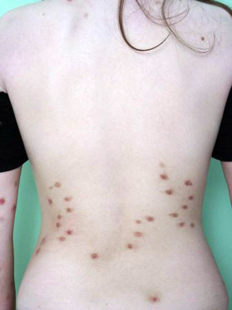 com.bmj.content.model.assessment.Caption@440757b4