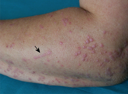 com.bmj.content.model.assessment.Caption@134edc67