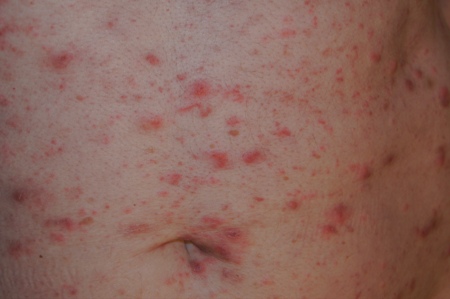 com.bmj.content.model.assessment.Caption@108f60d8