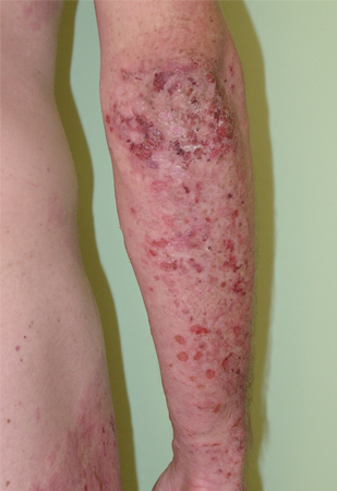 com.bmj.content.model.assessment.Caption@5b5f64e8