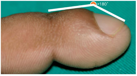 com.bmj.content.model.assessment.Caption@33a1236e