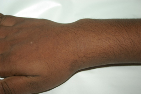 com.bmj.content.model.assessment.Caption@282e2677