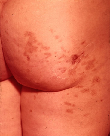 com.bmj.content.model.Caption@3b964cd4