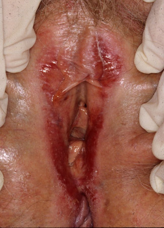 com.bmj.content.model.Caption@3e1a8847