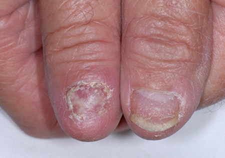 com.bmj.content.model.Caption@30fc0382