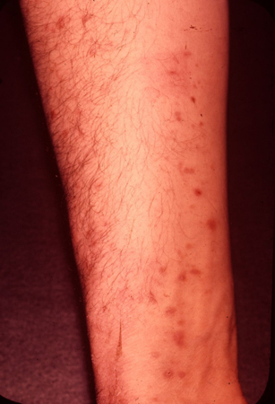 com.bmj.content.model.Caption@226b2b0c