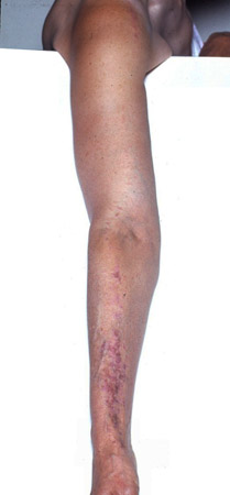 com.bmj.content.model.Caption@655238e7