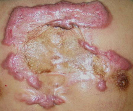 com.bmj.content.model.Caption@3b4735a8