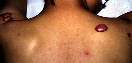 com.bmj.content.model.Caption@79e31d0e