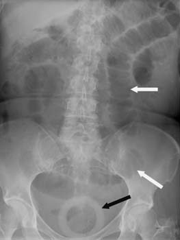 com.bmj.content.model.assessment.Caption@363d557e