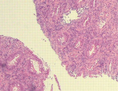 com.bmj.content.model.assessment.Caption@2a483ef6
