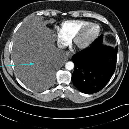 com.bmj.content.model.assessment.Caption@47606341