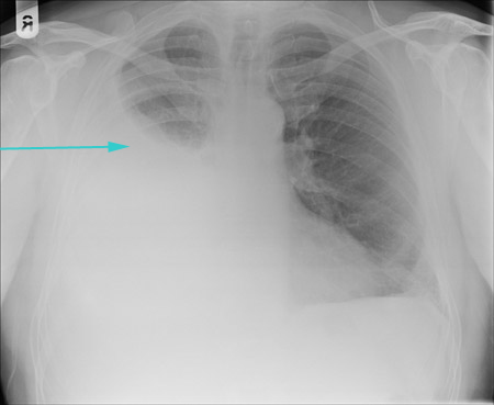 com.bmj.content.model.assessment.Caption@3819760b