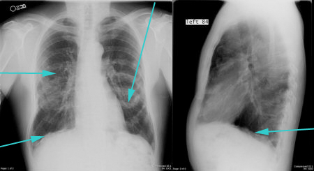 com.bmj.content.model.assessment.Caption@255eb78