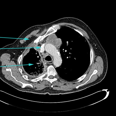 com.bmj.content.model.assessment.Caption@6863ff59