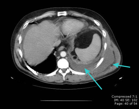 com.bmj.content.model.assessment.Caption@2181e43c