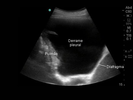 com.bmj.content.model.assessment.Caption@2565b87a