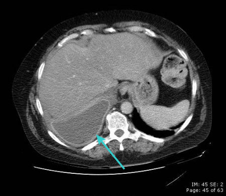 com.bmj.content.model.assessment.Caption@77100cd8